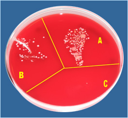 Microbial Growth